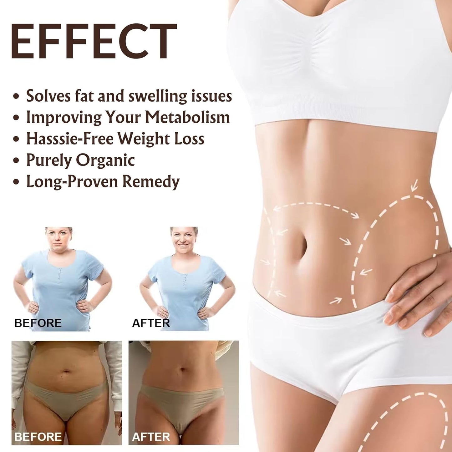 Enhanced Silicone Fusion Body Patch - Silicone Patches For Scars - Prevent and Treat Stretch Marks