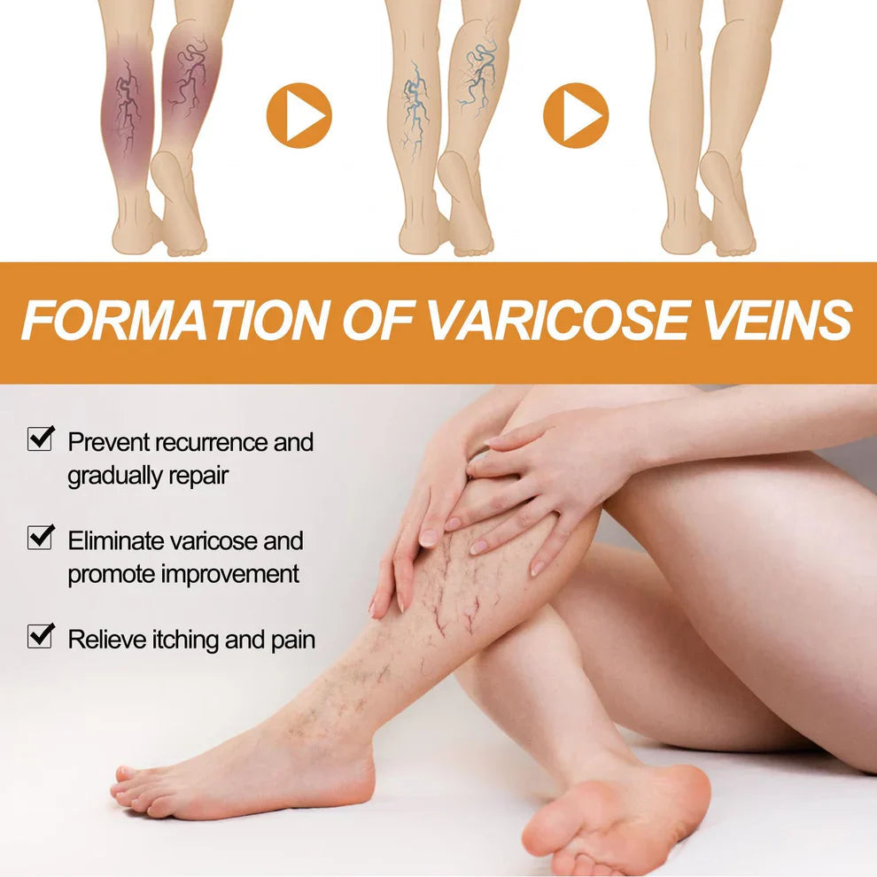 Turmeric Varicose Veins Relief Spray (BUY 1 GET 1 FREE💥 🎁 )