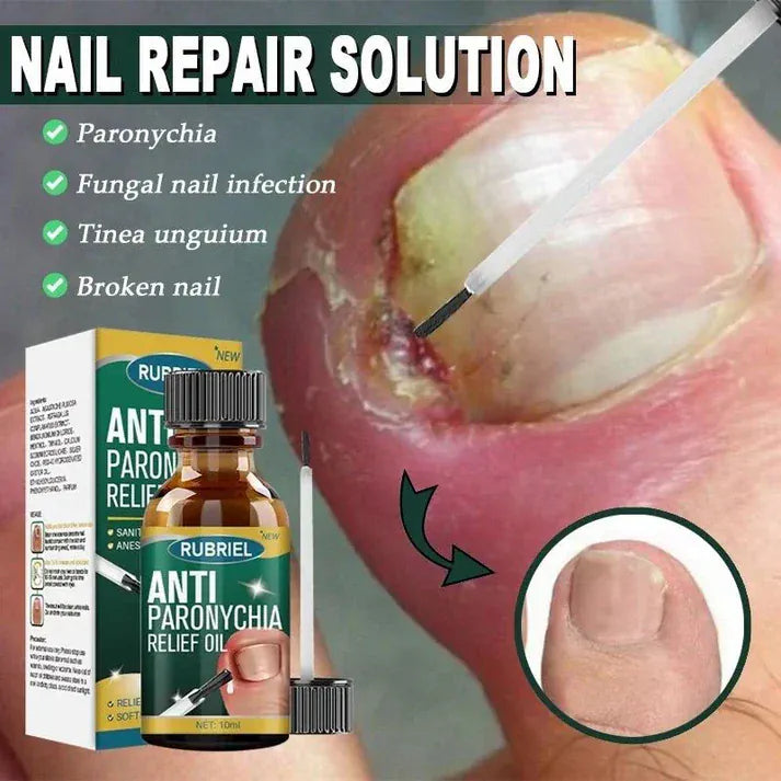 💅Anti-Paronychia Nail Relief Oil 🔥 Buy 1 Get 1 FREE @ Just ₹499! 🔥